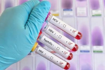 Going Viral: STIs and Love